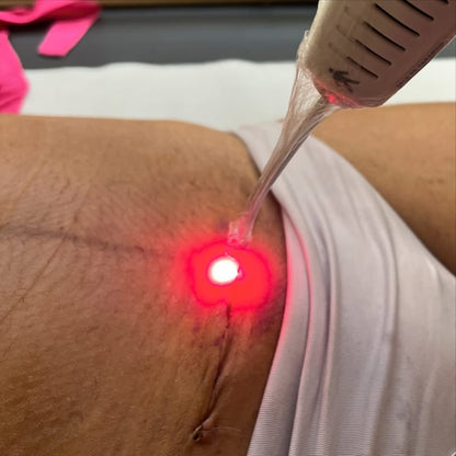 Infrared Red Light Therapy Lamp Cold Treatment cicatriz y heridas en los pezones a lactancia materna