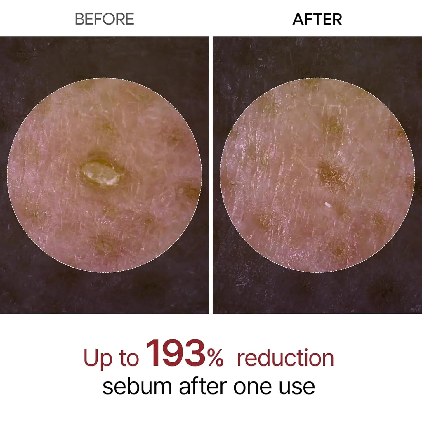 Dr. Melaxin Ampollas exfoliantes Rice Peeling y Ampoule Peel Shot Glow eliminador de piel muerta