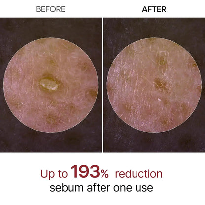 Dr. Melaxin Ampollas exfoliantes Rice Peeling y Ampoule Peel Shot Glow eliminador de piel muerta