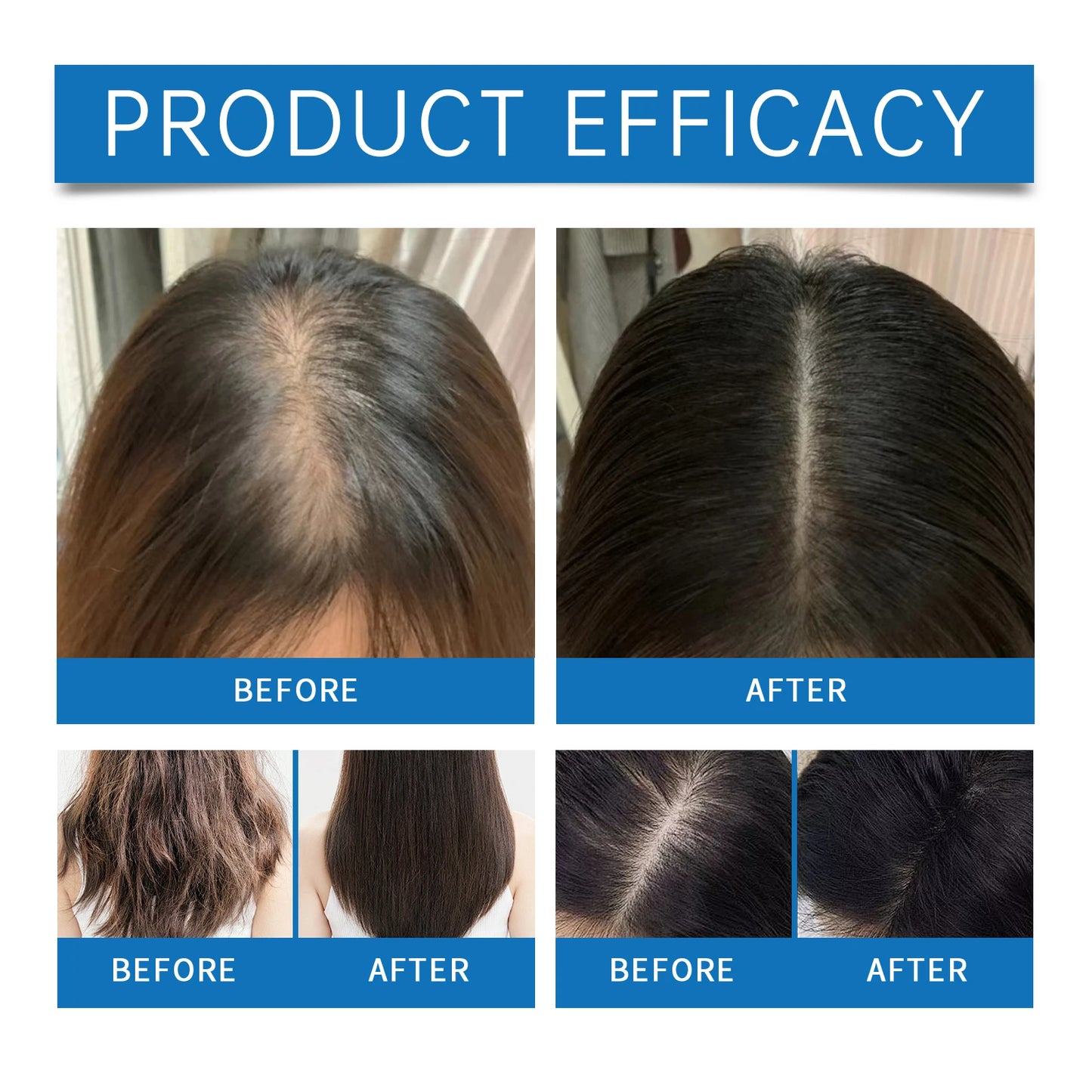 Aceite Ginger para el crecimiento del cabello raíces del cabello y cuero cabelludo Sérum para la caída del cabello Roller
